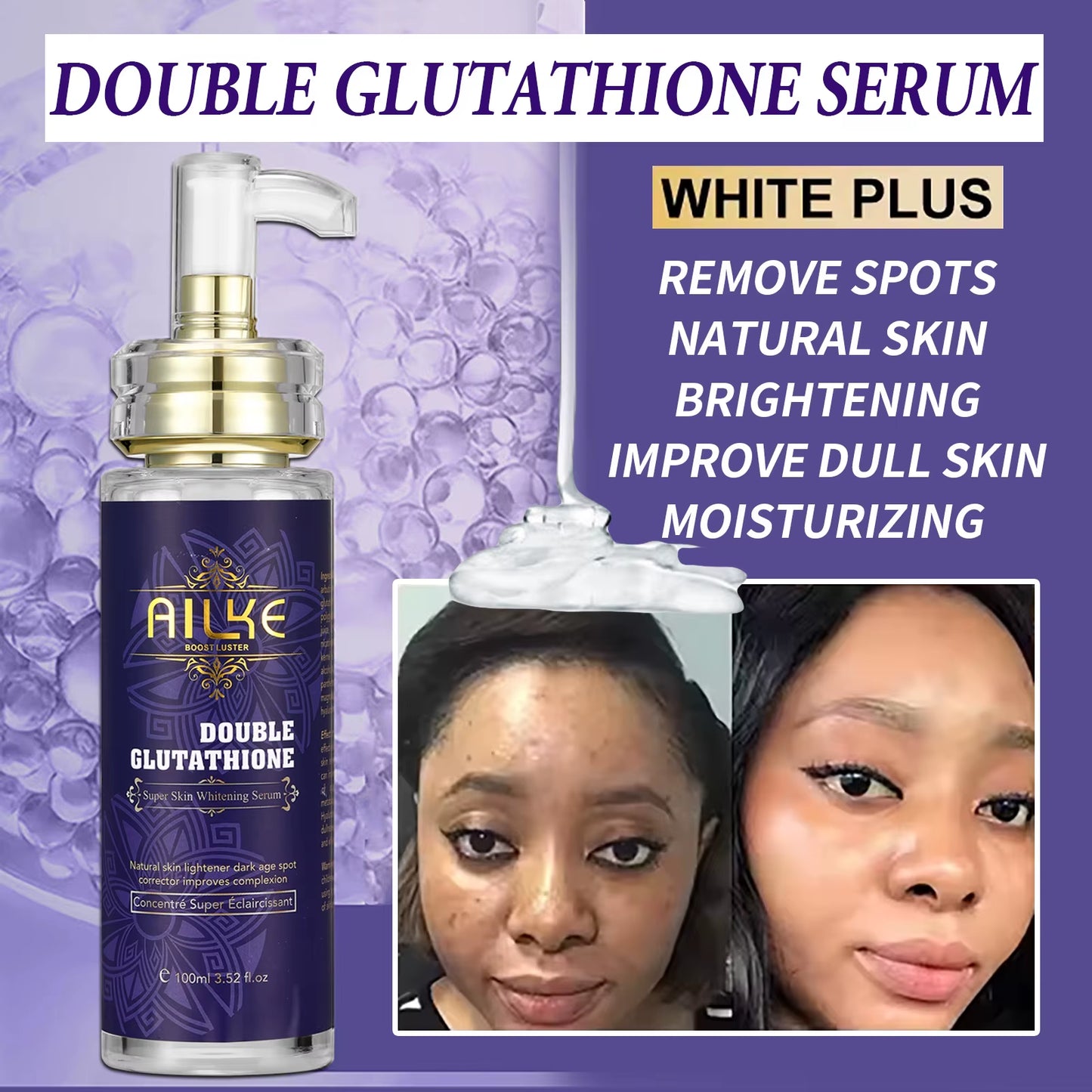 Dark Spot Remover Serum,Nourishing, Lightening, Even Skin Tone, Anti-Aging Freckle, for Face, Body, Women Personal Care